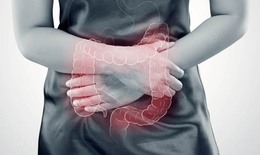 Cách nào giảm triệu chứng hội chứng ruột kích thích?