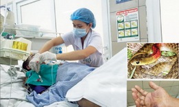 Suýt chết vì... rắn cảnh