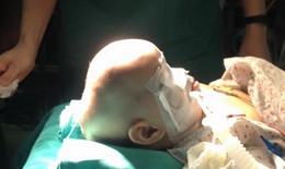 Bv Xanh Pôn: Phẫu thuật thành công hộp sọ biến dạng hình thuyền hiếm gặp cho bé 11 tháng tuổi