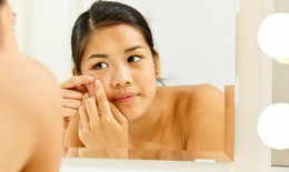 Muốn có làn da đẹp không tỳ vết đón Tết, tránh xa những thực phẩm này