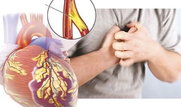 Người bệnh tim mạch, đái tháo đường và nguy cơ mắc Covid-19