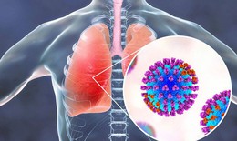 Dược thiện tăng cường miễn dịch cho người bị viêm nhiễm đường hô hấp