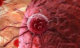 Khám phá cơ chế kháng thuốc của tế bào ung thư