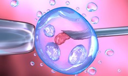 Xước niêm mạc tử cung không ảnh hưởng đến sinh thành công trong IVF