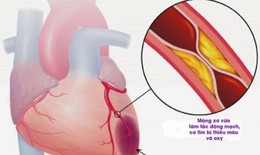 Chất chủ vận thụ thể GLP-1 cải thiện biến cố tim mạch