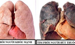 Nguy hiểm của khói thuốc lá trong đại dịch COVID-19