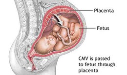 Phòng tránh nhiễm khuẩn thai nhi: Bảo vệ bé ngay từ trong bụng mẹ