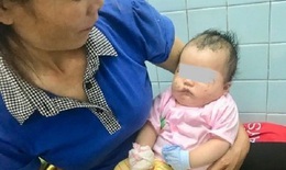 Đang ngủ trên võng, bé 2 tháng tuổi bị chó cắn phải nhập viện