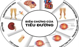 20 giây có một người bị cắt cụt chi, 6 giây lại có một người tử vong liên quan đến đái tháo đường.