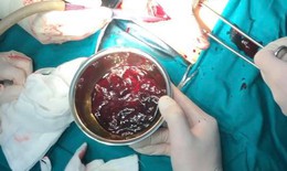 Chuyện thường ở viện: Nhân viên y tế hiến máu hiếm cứu thai phụ chửa ngoài tử cung bị vỡ
