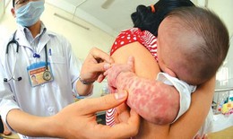 WHO cảnh báo: Không tiêm vắc xin - Mối nguy hiểm đầu tiên cho sức khoẻ toàn cầu