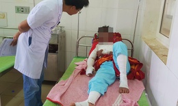 Quảng Trị: Điện thoại phát nổ khi đang sạc,thanh niên bị thương nặng