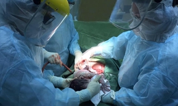Phẫu thuật lấy thai an to&#224;n cho sản phụ đang trong khu c&#225;ch ly ph&#242;ng, chống bệnh COVID -19