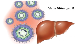 Việt Nam đang nằm trong vùng có tỷ lệ lây nhiềm virus viêm gan cao nhất