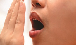 Thuốc nào trị hôi miệng?
