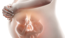 Biến chứng trong thai kỳ ở những phụ nữ c&#243; hội chứng buồng trứng đa nang