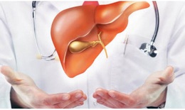 Thuốc bổ gan, giải độc gan:  Không thể dùng tùy tiện