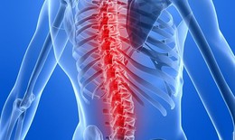 Lao cột sống có lây?