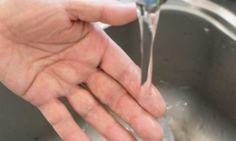 Xác định và xử trí điều trị bỏng