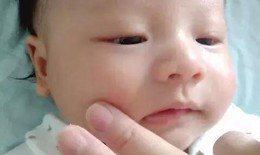 Đa dạng thị trường kem bôi nẻ: Cần thận trọng chọn dùng cho trẻ