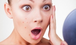 Các thuốc dễ gây nổi mụn