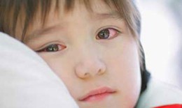 Đau mắt đỏ, đừng tự chữa  khiến bệnh lành tính bị biến chứng nặng