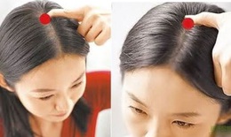 Phục hồi di chứng tai biến mạch máu não