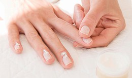 Biểu hiện khi bị nấm móng