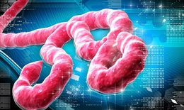 Cẩn trọng với sát thủ Ebola