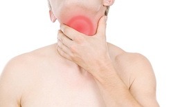 Viêm họng và lạm dụng kháng sinh