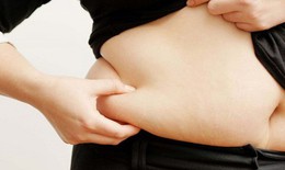 Béo phì khiến phụ nữ dễ mắc ung thư đại trực tràng sớm