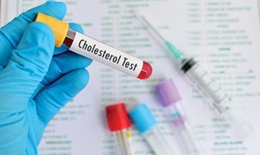 Cholesterol v&#224; những c&#225;ch kiểm so&#225;t