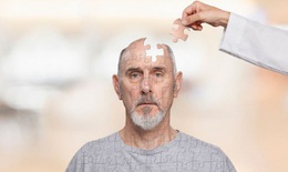 Bệnh Alzheimer phát hiện và điều trị?
