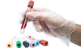 Xét nghiệm máu có thể ngăn ngừa cơn đột quỵ