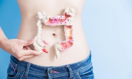 Các thuốc điều trị bệnh viêm trực tràng