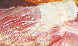 Thực hư về bệnh sán dây!