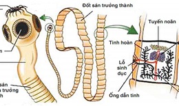Sán dây lợn gây bệnh ở người như thế nào?