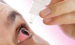 Lựa chọn thuốc trị viêm kết mạc dị ứng