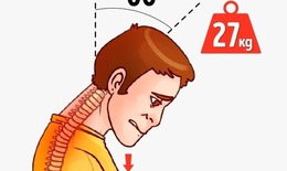 Xử lý chứng nặng đầu