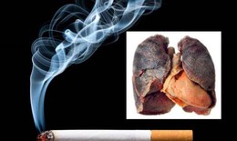 Nguy cơ ung thư phổi từ bệnh COPD