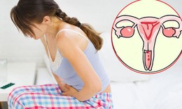 Chất lượng sống sau khi điều trị ung thư cổ tử cung