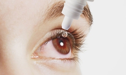Viêm giác mạc sợi -  bệnh lý mắt thường gặp
