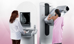 Chụp Xquang tuyến vú có thể dự báo nguy cơ mắc bệnh tim