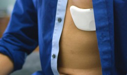 Miếng dán đo nhịp tim Life Rx