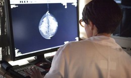 Chẩn đoán ung thư vú bằng trí tuệ nhân tạo