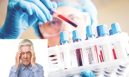 Xét nghiệm máu giúp chẩn đoán Alzheimer