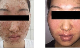 L&#224;m đẹp tr&#234;n mạng (online), hệ lụy kh&#244;n lường