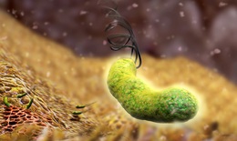 Diệt vi khuẩn H.Pylori: Loại bỏ một nguy cơ gây ung thư dạ dày