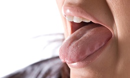 Khô miệng, vì sao?