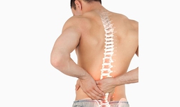 Bệnh loãng xương - nỗi lo âu có thể phòng ngừa